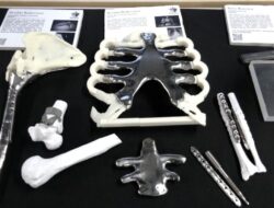 AI Bisa Rekonstruksi Medis dengan X-ray Tanpa CT Scan
