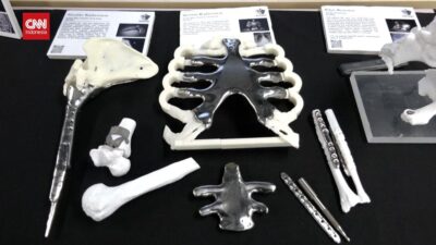 AI Bisa Rekonstruksi Medis dengan X-ray Tanpa CT Scan